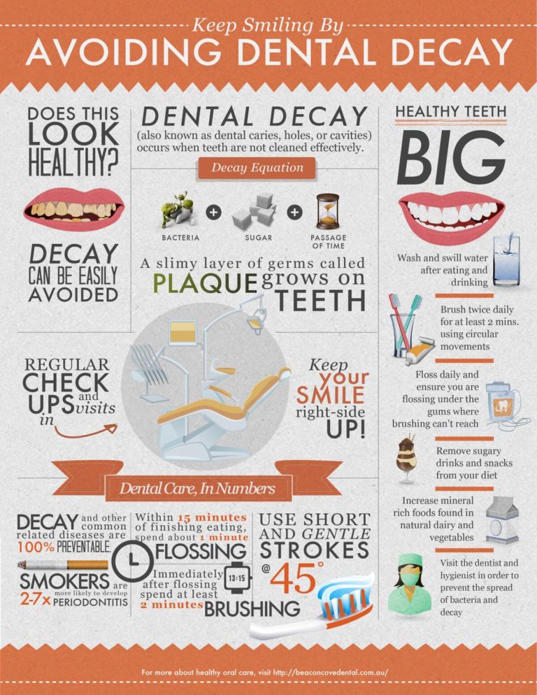 infographic on how to prevent tooth decay